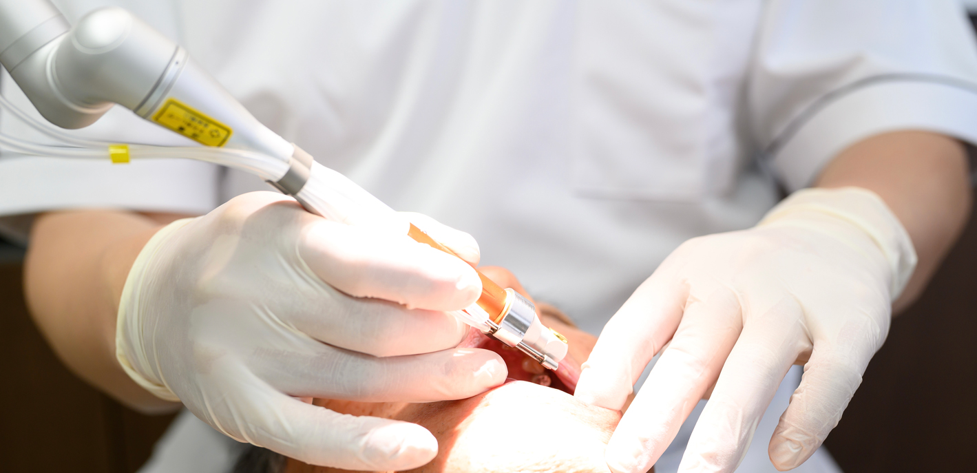 レーザーを用いた治療